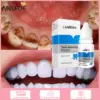 Lanbena Teeth Whitening Essence-0.35 floz 10ml